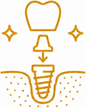 Dental implant illustration showing a tooth crown, abutment, and implant screw, symbolizing the dental implant process for restoring oral health at LuxOra Dental Practice.
