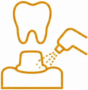 Dental crown preparation process, featuring a hand spraying dental material onto a tooth model, illustrating restorative dental care techniques at LuxOra Dental.