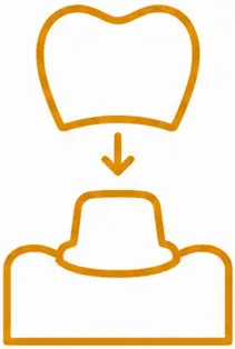 Illustration of a dental crown being placed on a prepared tooth, representing the crown and bridge process at LuxOra Dental.